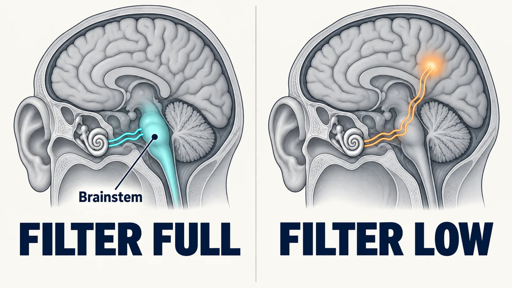 Two views of the brainstem filter: full, it blocks stray signals; low, they get through.