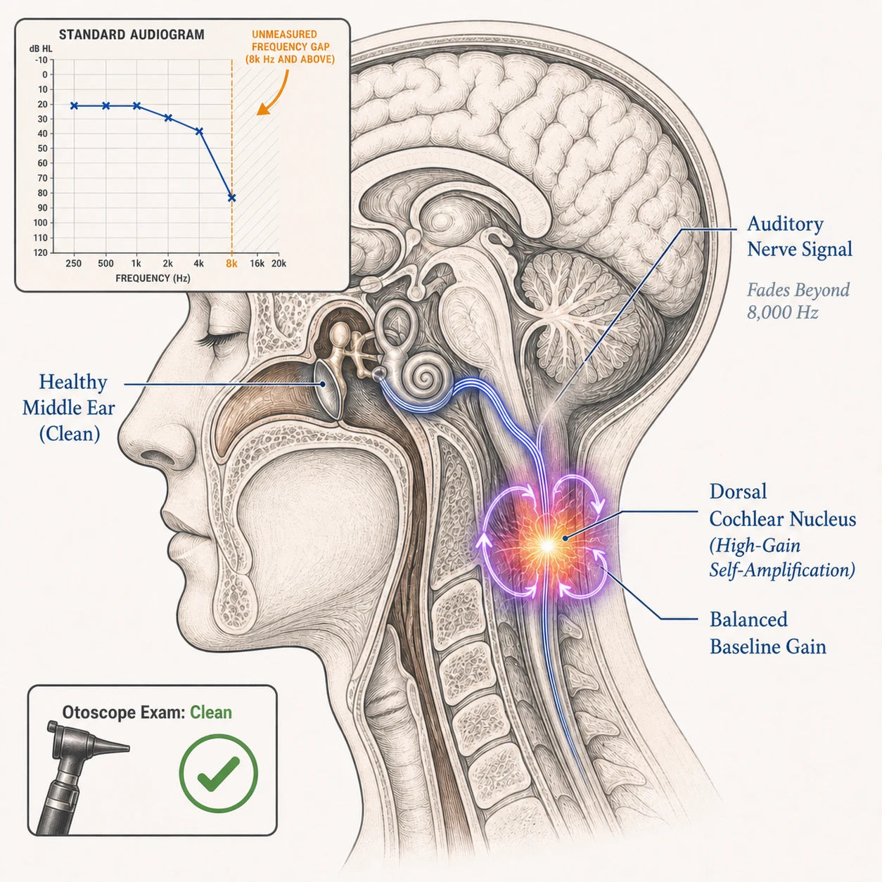 Volume control turned up too far at the dorsal cochlear nucleus