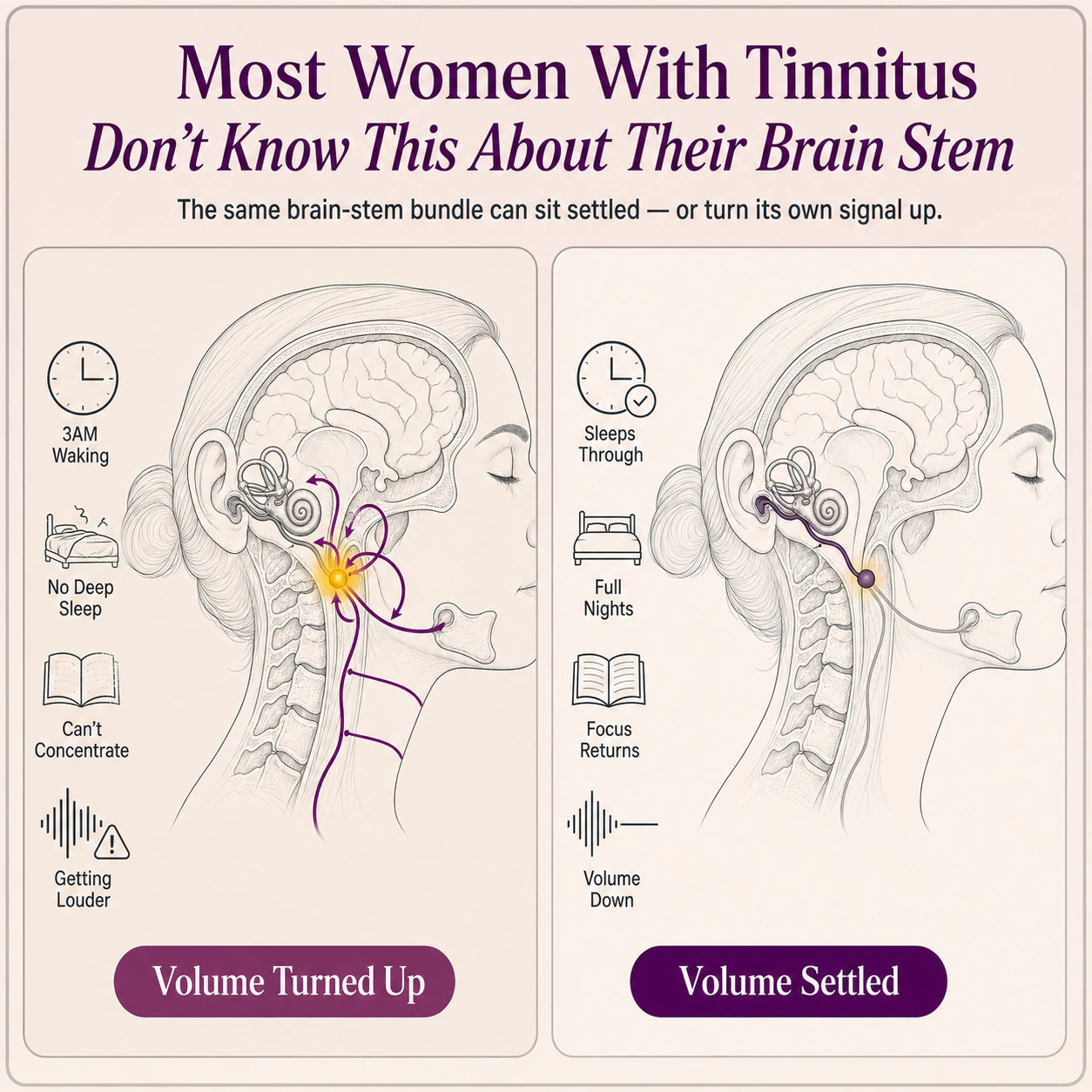 Comparison of the tinnitus volume control turned up and settled
