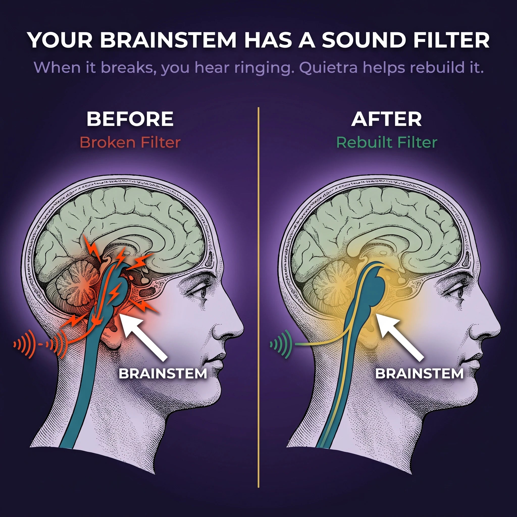 Brainstem sound filter before and after comparison