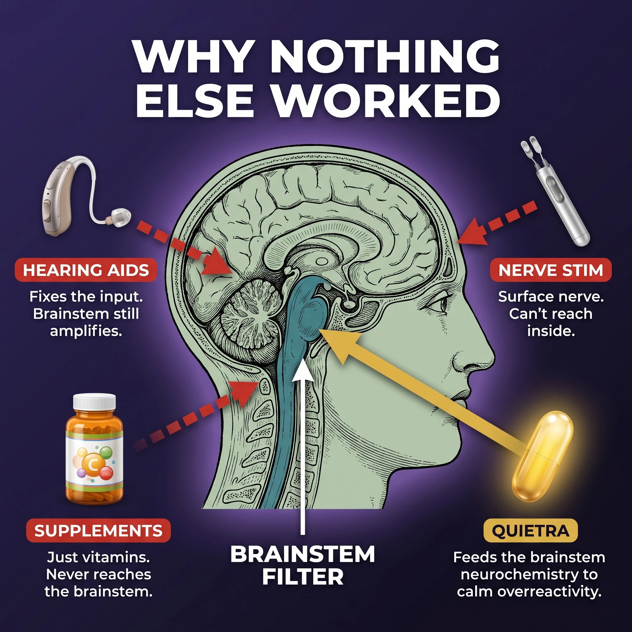 Why supplements hearing aids and nerve stimulation miss the brainstem filter